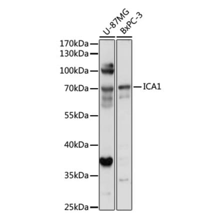 Western Blot - Anti-ICA69 Antibody (A307772) - Antibodies.com