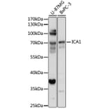 Western Blot - Anti-ICA69 Antibody (A307772) - Antibodies.com