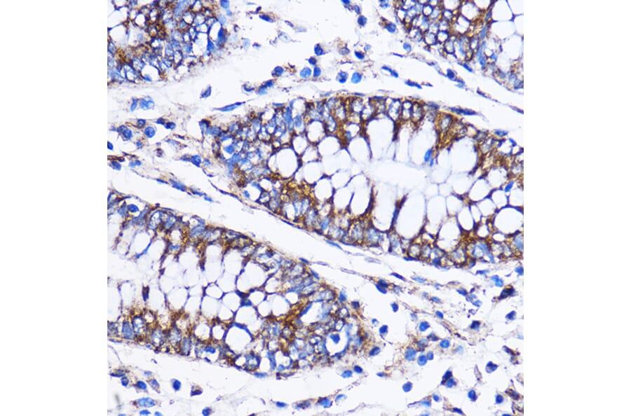 Immunohistochemistry - Anti-ICA69 Antibody (A307772) - Antibodies.com