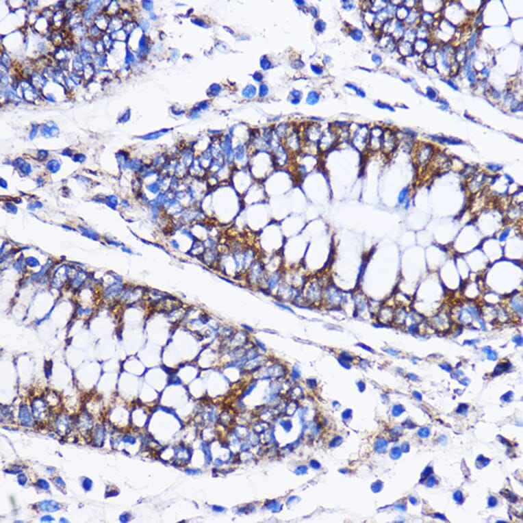 Immunohistochemistry - Anti-ICA69 Antibody (A307772) - Antibodies.com