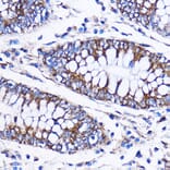 Immunohistochemistry - Anti-ICA69 Antibody (A307772) - Antibodies.com
