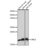 Western Blot - Anti-UBE2I/UBC9 Antibody [ARC0996] (A307773) - Antibodies.com