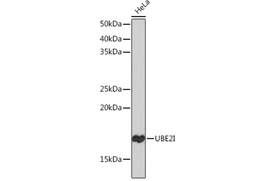 Western Blot - Anti-UBE2I/UBC9 Antibody [ARC0996] (A307773) - Antibodies.com