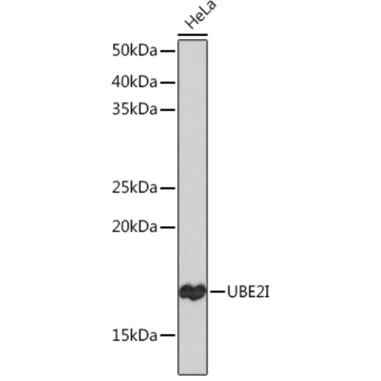 Western Blot - Anti-UBE2I/UBC9 Antibody [ARC0996] (A307773) - Antibodies.com