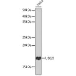 Western Blot - Anti-UBE2I/UBC9 Antibody [ARC0996] (A307773) - Antibodies.com