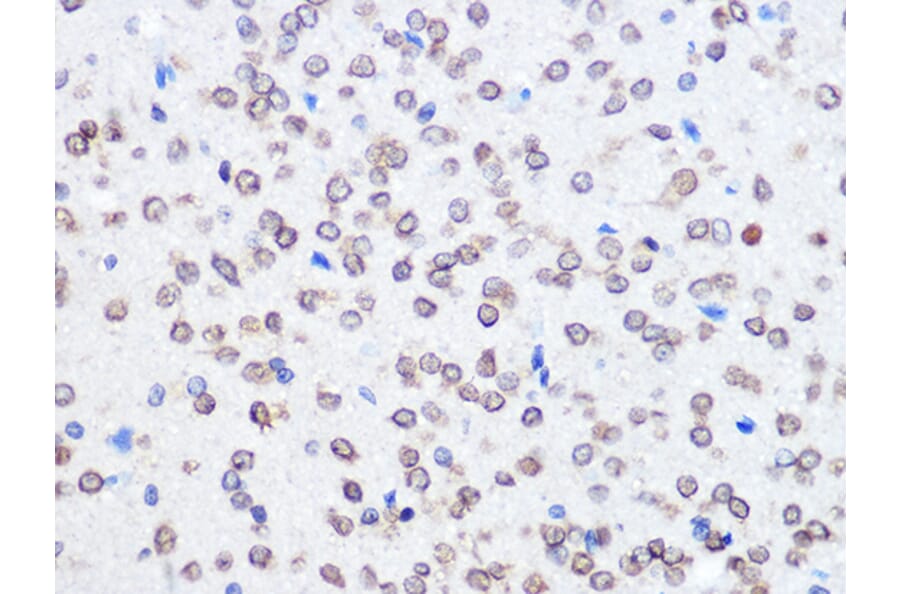 Immunohistochemistry - Anti-UBE2I/UBC9 Antibody [ARC0996] (A307773) - Antibodies.com