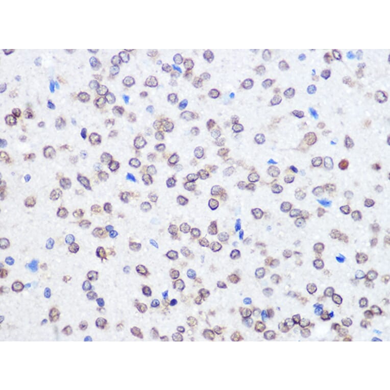 Immunohistochemistry - Anti-UBE2I/UBC9 Antibody [ARC0996] (A307773) - Antibodies.com