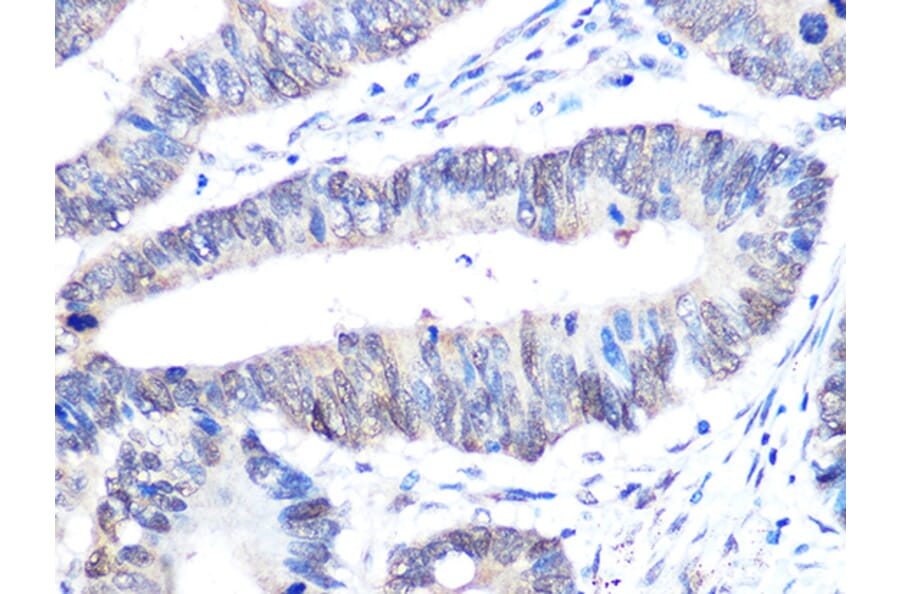 Immunohistochemistry - Anti-UBE2I/UBC9 Antibody [ARC0996] (A307773) - Antibodies.com
