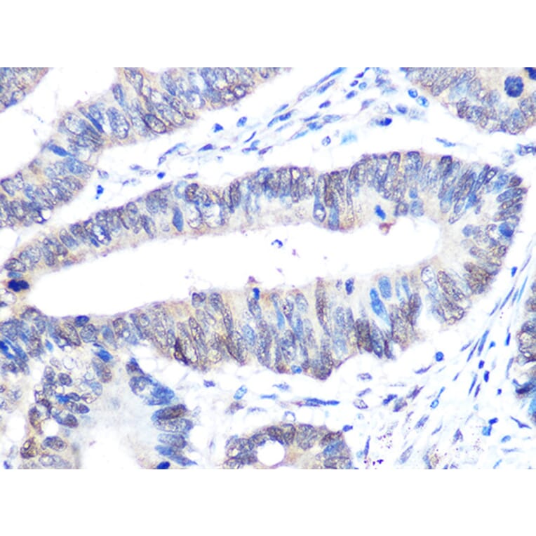 Immunohistochemistry - Anti-UBE2I/UBC9 Antibody [ARC0996] (A307773) - Antibodies.com