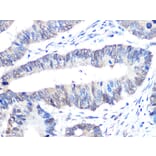 Immunohistochemistry - Anti-UBE2I/UBC9 Antibody [ARC0996] (A307773) - Antibodies.com