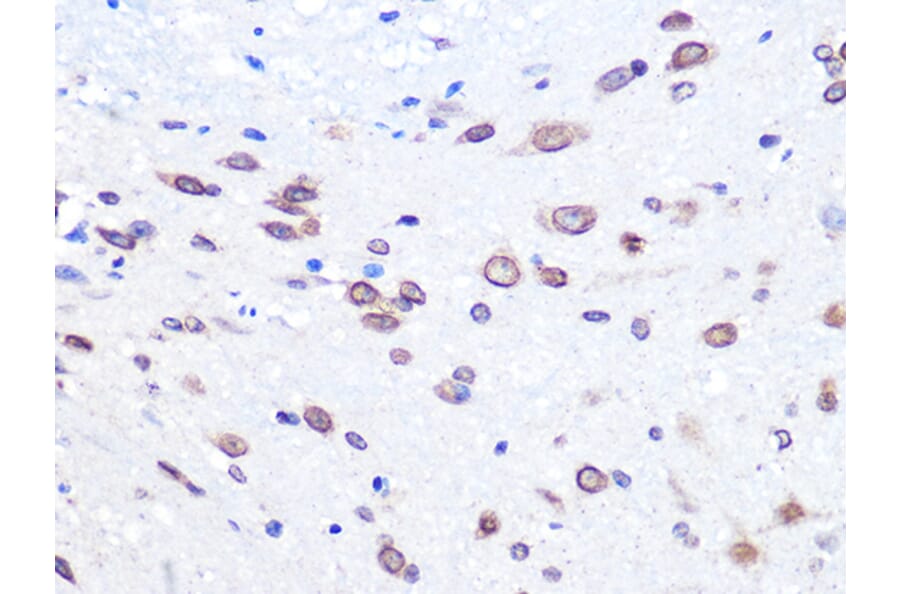 Immunohistochemistry - Anti-UBE2I/UBC9 Antibody [ARC0996] (A307773) - Antibodies.com