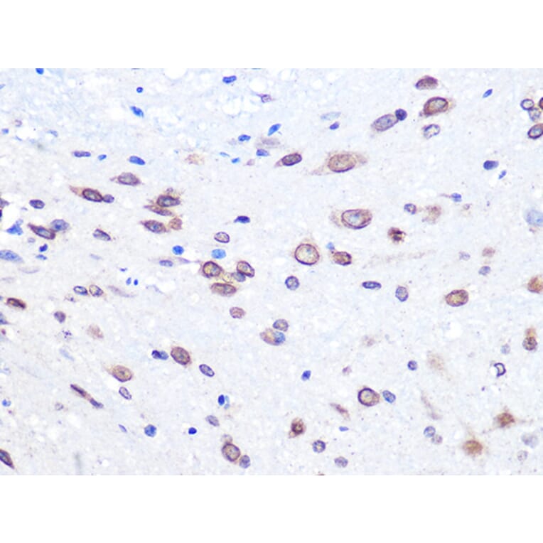 Immunohistochemistry - Anti-UBE2I/UBC9 Antibody [ARC0996] (A307773) - Antibodies.com