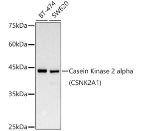 Western Blot - Anti-CSNK2A1 Antibody [ARC0163] (A307775) - Antibodies.com