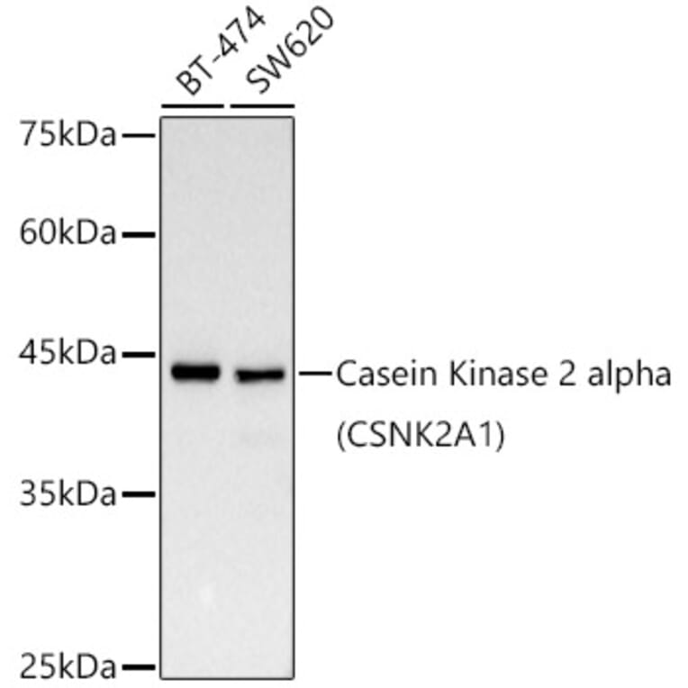 Western Blot - Anti-CSNK2A1 Antibody [ARC0163] (A307775) - Antibodies.com