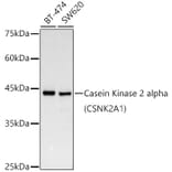 Western Blot - Anti-CSNK2A1 Antibody [ARC0163] (A307775) - Antibodies.com