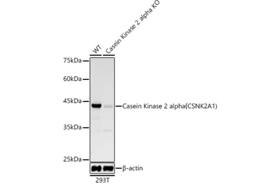 Western Blot - Anti-CSNK2A1 Antibody [ARC0163] (A307775) - Antibodies.com