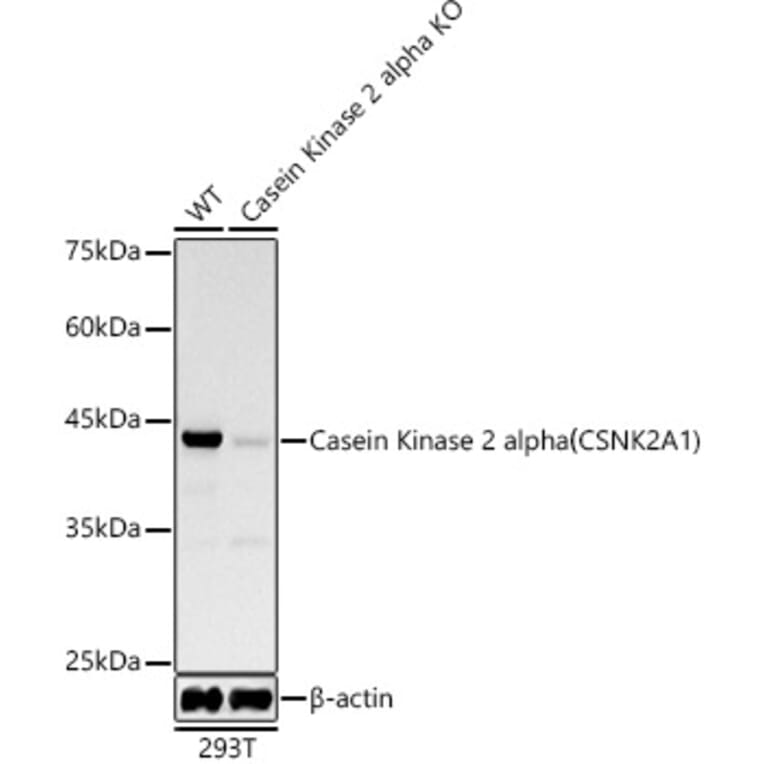 Western Blot - Anti-CSNK2A1 Antibody [ARC0163] (A307775) - Antibodies.com