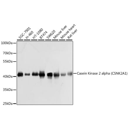 Western Blot - Anti-CSNK2A1 Antibody (A307776) - Antibodies.com