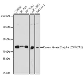 Western Blot - Anti-CSNK2A1 Antibody (A307777) - Antibodies.com