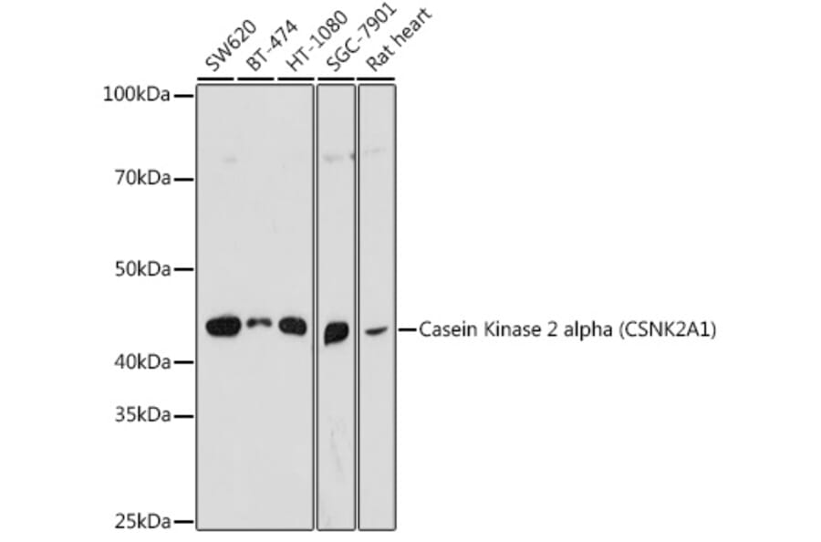 Western Blot - Anti-CSNK2A1 Antibody (A307777) - Antibodies.com