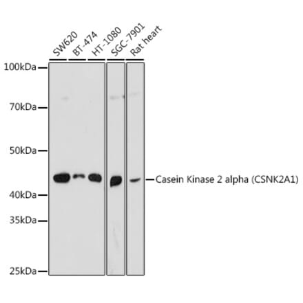 Western Blot - Anti-CSNK2A1 Antibody (A307777) - Antibodies.com