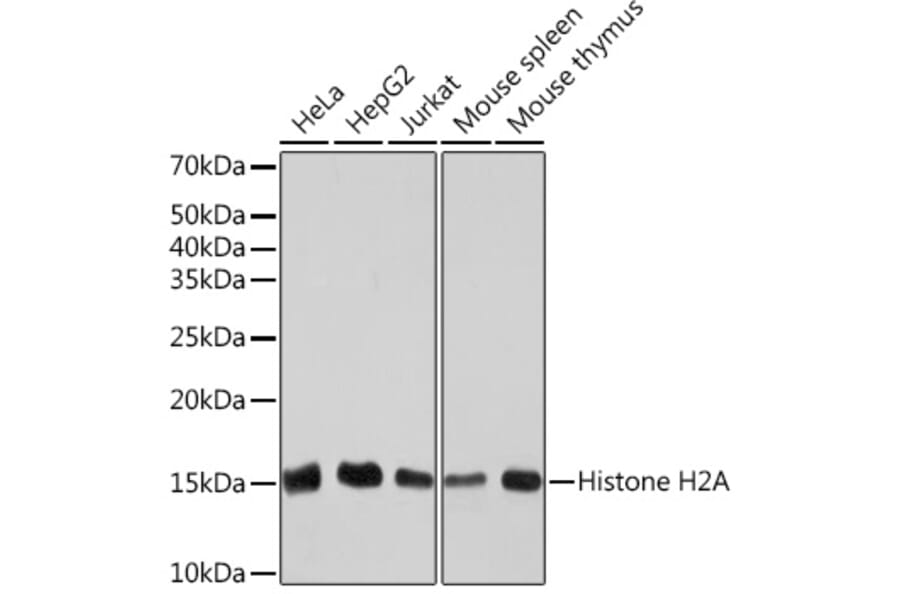 Western Blot - Anti-Histone H2A Antibody [ARC2072] (A307778) - Antibodies.com