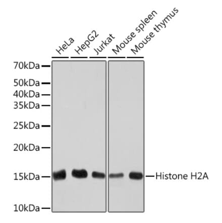 Western Blot - Anti-Histone H2A Antibody [ARC2072] (A307778) - Antibodies.com