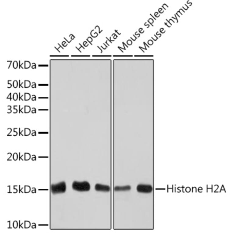 Western Blot - Anti-Histone H2A Antibody [ARC2072] (A307778) - Antibodies.com