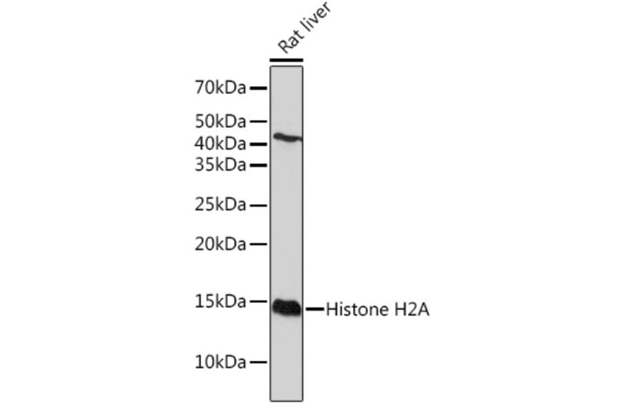 Western Blot - Anti-Histone H2A Antibody [ARC2072] (A307778) - Antibodies.com