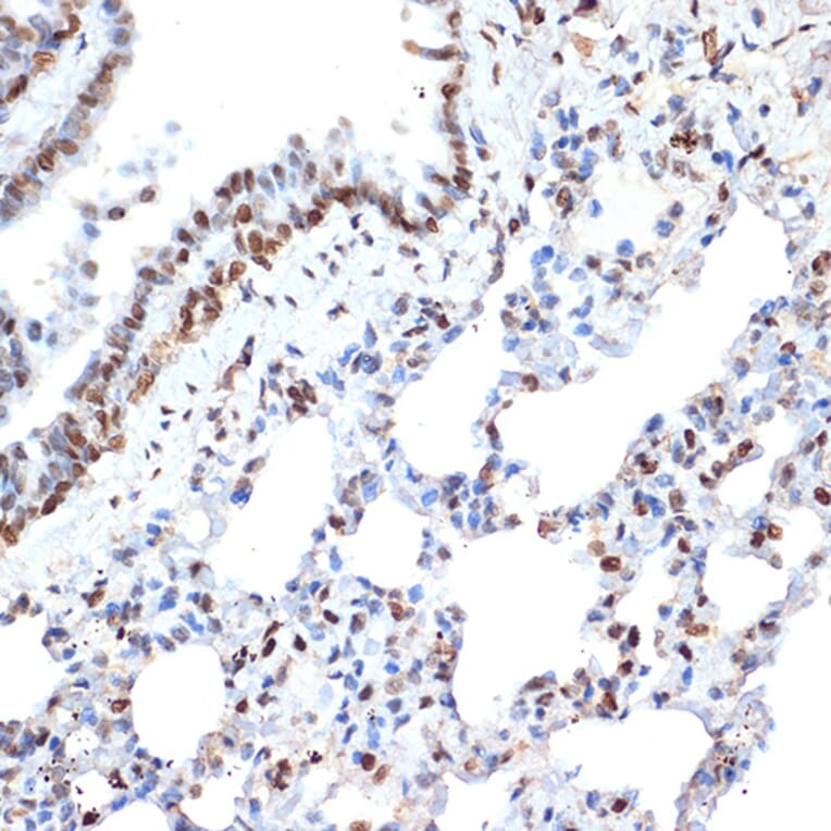 Immunohistochemistry - Anti-Histone H2A Antibody [ARC2072] (A307778) - Antibodies.com