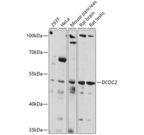 Western Blot - Anti-DCDC2 Antibody (A307780) - Antibodies.com