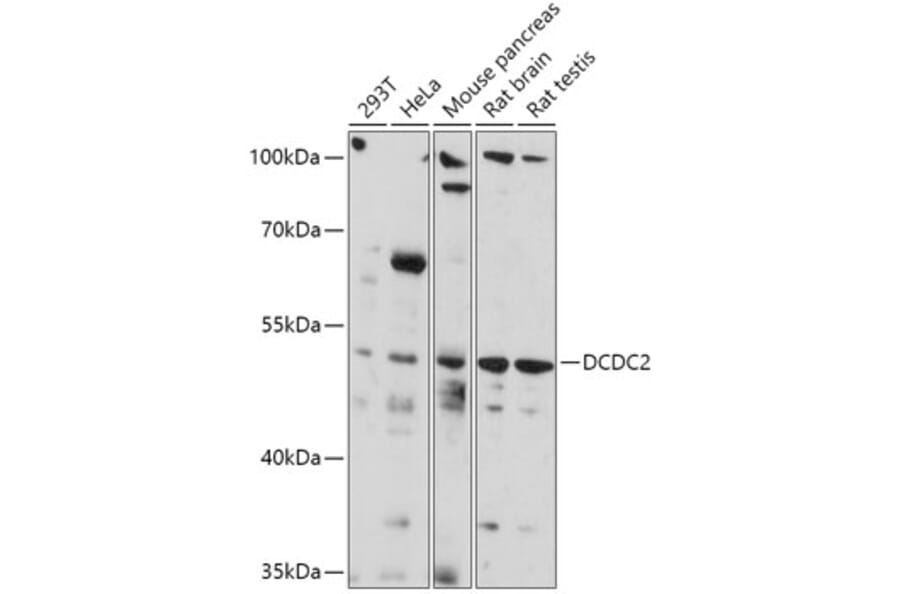Western Blot - Anti-DCDC2 Antibody (A307780) - Antibodies.com
