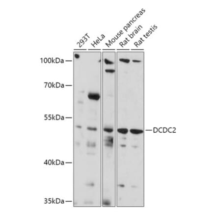 Western Blot - Anti-DCDC2 Antibody (A307780) - Antibodies.com