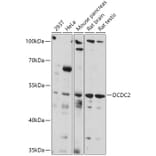 Western Blot - Anti-DCDC2 Antibody (A307780) - Antibodies.com