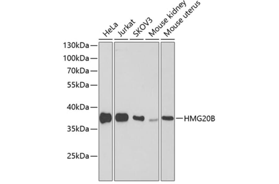 Western Blot - Anti-BRAF35 Antibody (A307781) - Antibodies.com