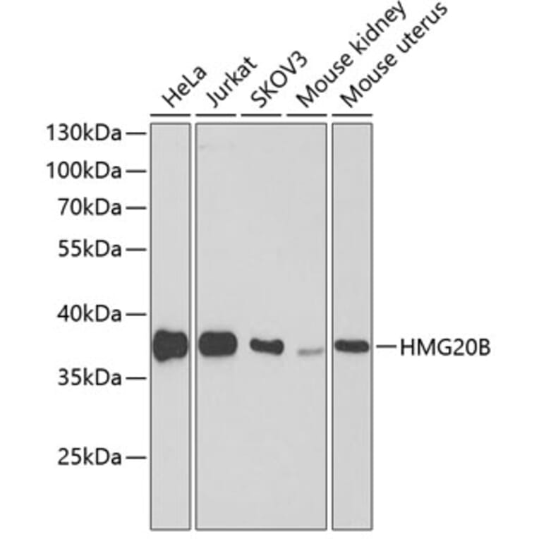 Western Blot - Anti-BRAF35 Antibody (A307781) - Antibodies.com