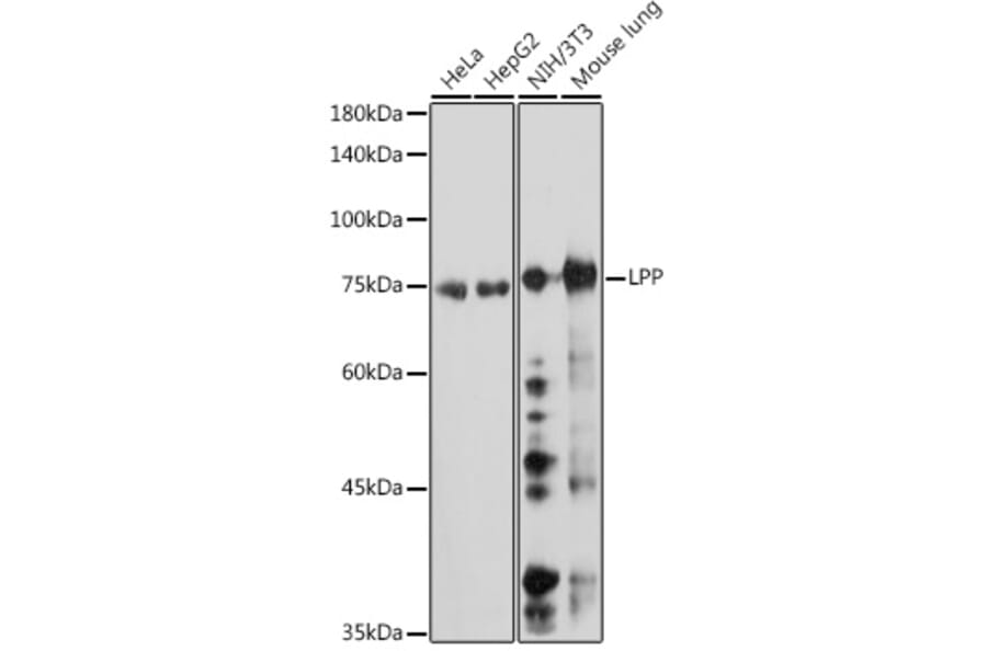 Western Blot - Anti-LPP Antibody [ARC2381] (A307783) - Antibodies.com