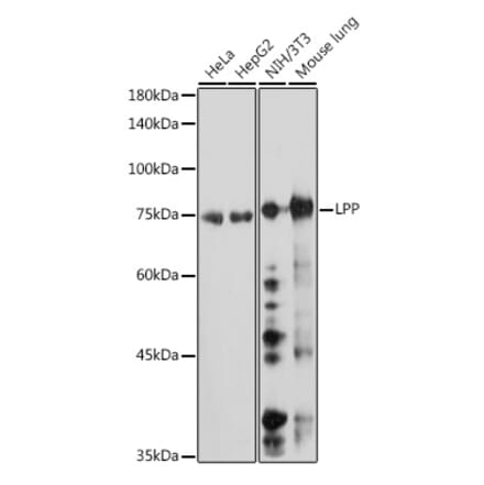 Western Blot - Anti-LPP Antibody [ARC2381] (A307783) - Antibodies.com