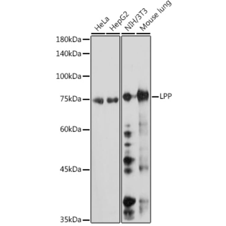 Western Blot - Anti-LPP Antibody [ARC2381] (A307783) - Antibodies.com