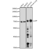 Western Blot - Anti-LPP Antibody [ARC2381] (A307783) - Antibodies.com