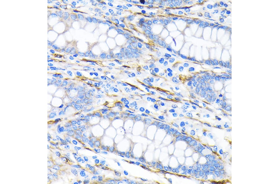 Immunohistochemistry - Anti-LPP Antibody [ARC2381] (A307783) - Antibodies.com