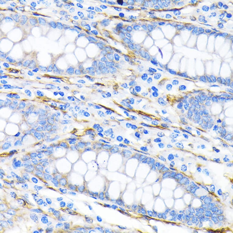 Immunohistochemistry - Anti-LPP Antibody [ARC2381] (A307783) - Antibodies.com
