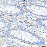 Immunohistochemistry - Anti-LPP Antibody [ARC2381] (A307783) - Antibodies.com
