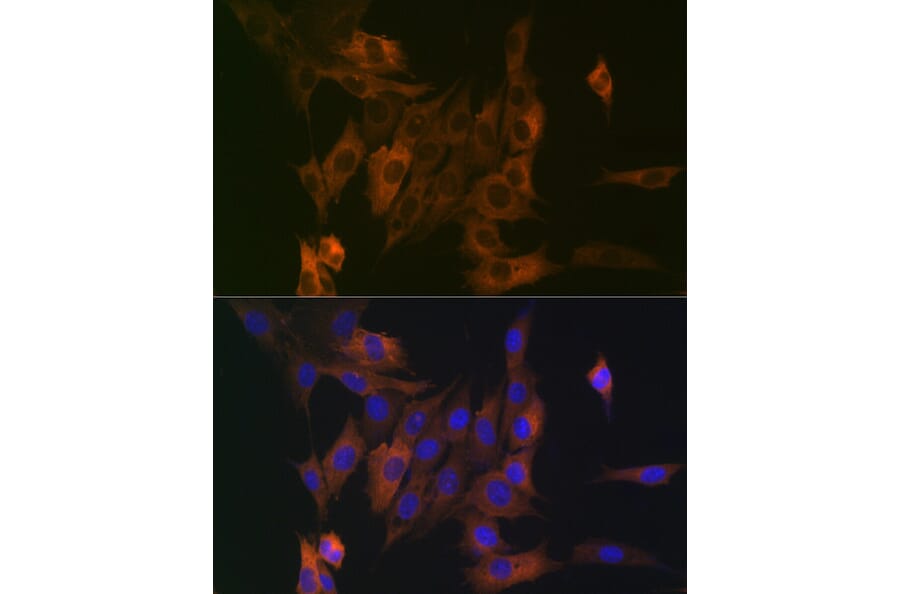 Immunofluorescence - Anti-LPP Antibody [ARC2381] (A307783) - Antibodies.com