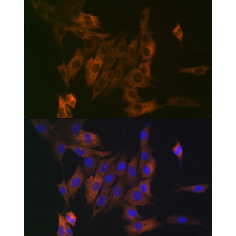 Immunofluorescence - Anti-LPP Antibody [ARC2381] (A307783) - Antibodies.com
