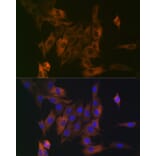 Immunofluorescence - Anti-LPP Antibody [ARC2381] (A307783) - Antibodies.com