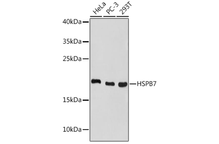 Western Blot - Anti-HSPB7 Antibody (A307784) - Antibodies.com
