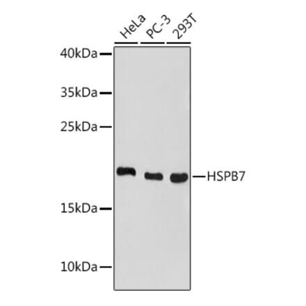 Western Blot - Anti-HSPB7 Antibody (A307784) - Antibodies.com