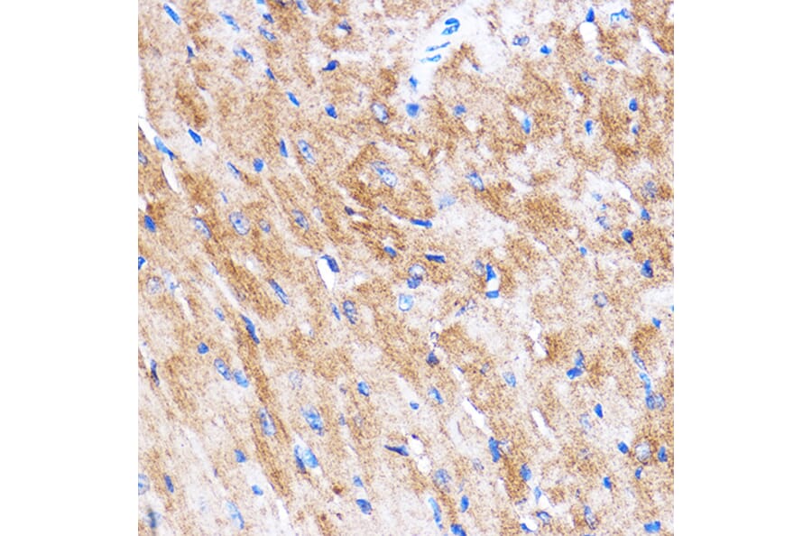 Immunohistochemistry - Anti-HSPB7 Antibody (A307784) - Antibodies.com