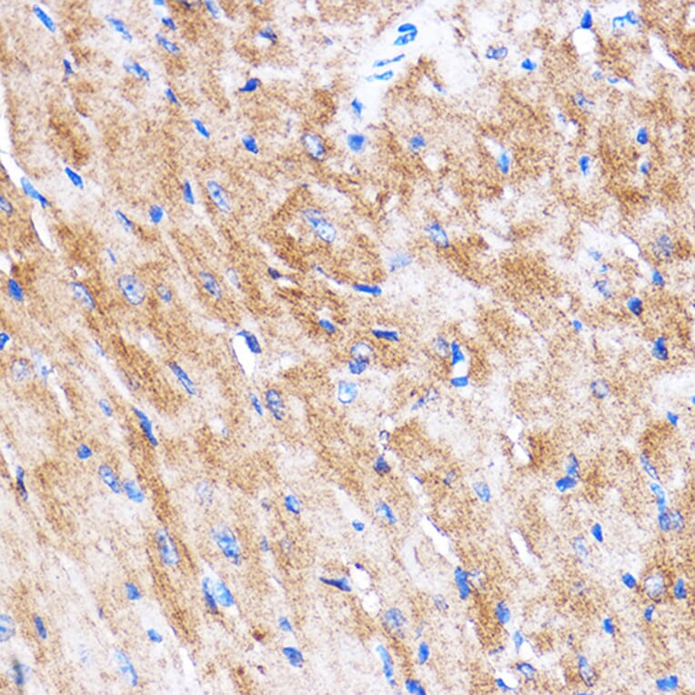 Immunohistochemistry - Anti-HSPB7 Antibody (A307784) - Antibodies.com